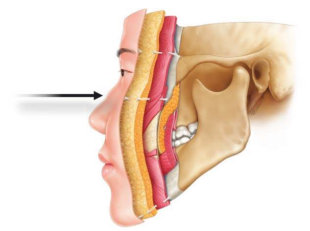 Skeletal illustration of profiled skull